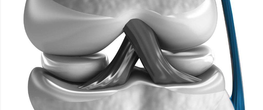 HIPERLAXITUD E INESTABILIDAD ARTICULAR